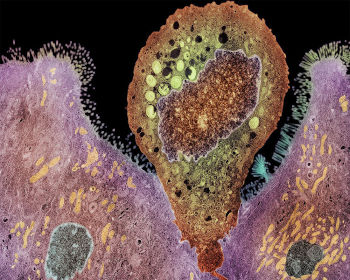 Enterocytozoon bieneusi (al centro) a contatto con cellule dell'intestino umano – Immagine di micrografia elettronica a trasmissione colorata (TEM) da London School Of Hygiene & Tropical Medicine